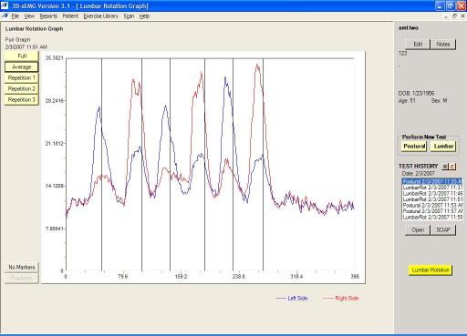 Rotational Spinal Muscle Activation post ATM2 